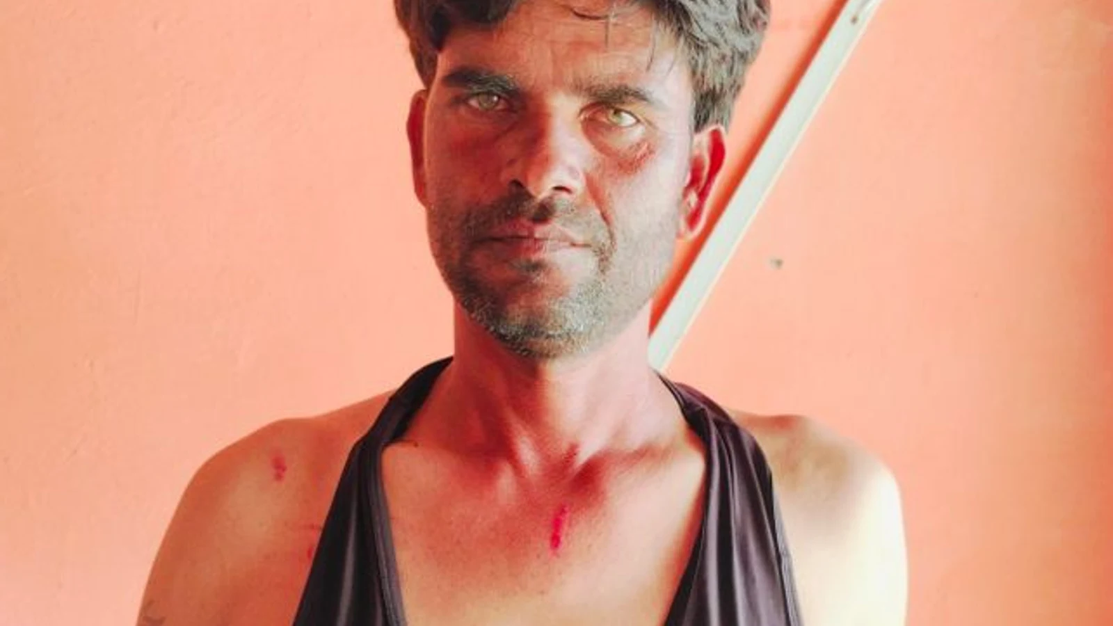 द न्यूज़ 100 डेस्क: युवक से मारपीट और चाकू से हमले की शिकायत से जुड़ा समाचार चित्र