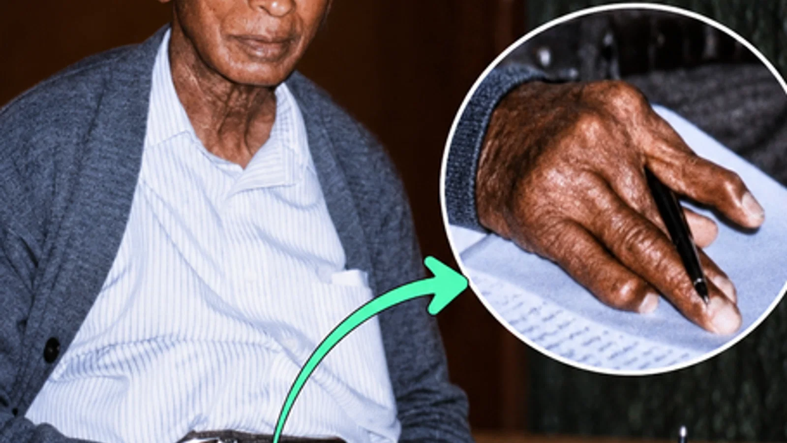 अंतरराष्ट्रीय घटनाक्रम: Arthritis Bent His Fingers. Yet This Doc Performed को लेकर बड़ा अपडेट व आधिकारिक रिपोर्ट