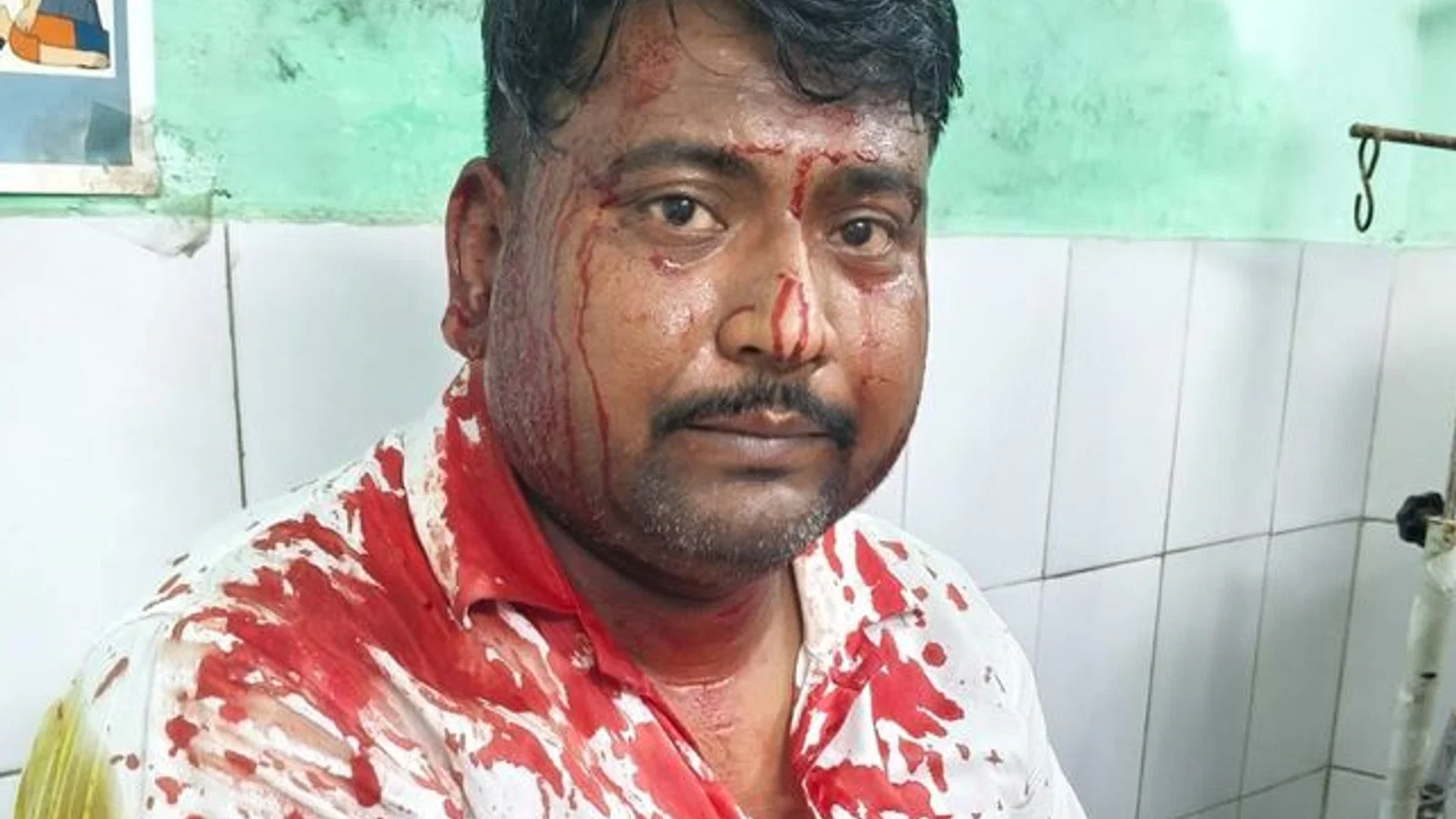 द न्यूज़ 100 डेस्क: काकोरी में प्रॉपर्टी डीलर पर लोहे की रॉड से हमला से जुड़ा समाचार चित्र