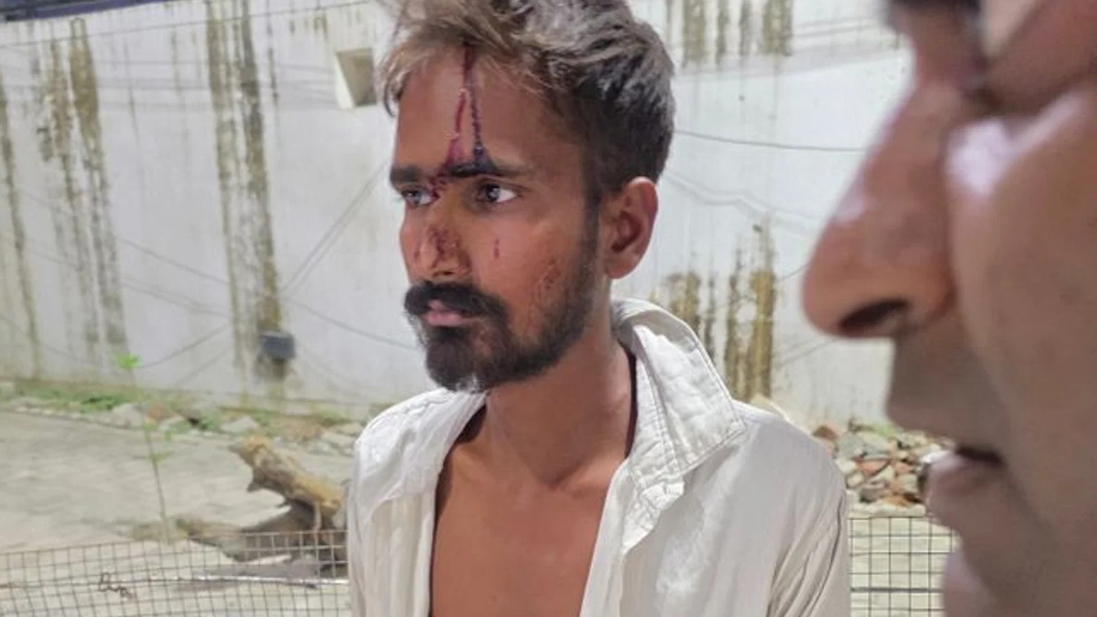 युवक से गाली-गलौज और लाठी-डंडों से मारपीट: शाहाबाद में दबंगों ने किया हमला, सिर में चोटें आईं