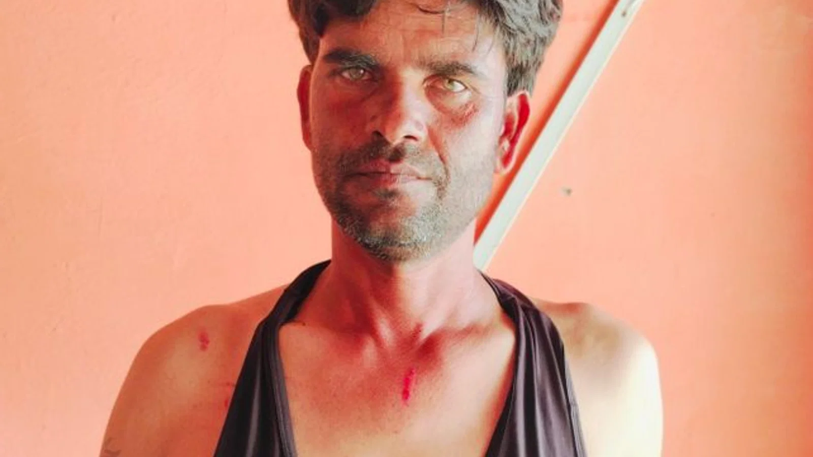 युवक से मारपीट और चाकू से हमले की शिकायत: दादों में भवानीपुर खुर्द में रास्ते में रोकने का आरोप